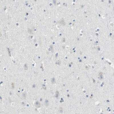 Immunohistochemistry-Paraffin: Granzyme M Antibody [NBP2-14079]