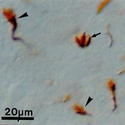 Immunohistochemistry-Paraffin: Growth Cone Antibody (2G13) [NB600-785]