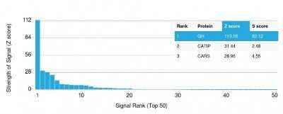 Protein Array: Growth Hormone Antibody (GH/1371) - Azide and BSA Free [NBP2-54361]