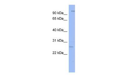Western Blot: Gsh1 Antibody [NBP3-10911]