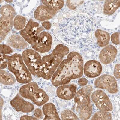 Immunohistochemistry-Paraffin: Guanine deaminase Antibody [NBP1-87454]