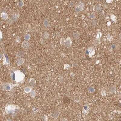 Immunohistochemistry-Paraffin: Guanine deaminase Antibody [NBP1-87454]