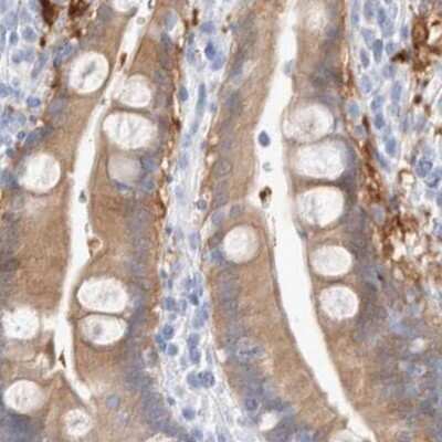 Immunohistochemistry-Paraffin: Guanine deaminase Antibody [NBP1-87454]
