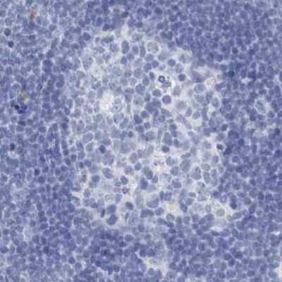 Immunohistochemistry-Paraffin: Guanine deaminase Antibody [NBP1-87454]