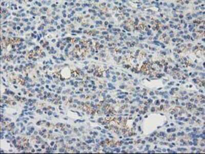 Immunohistochemistry-Paraffin: Guanylate kinase Antibody (OTI4A8) [NBP2-00594]