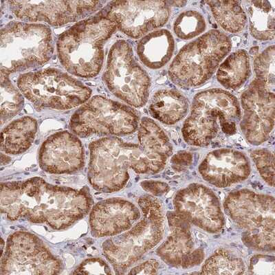 Immunohistochemistry-Paraffin: Guanylate kinase Antibody [NBP2-14078]