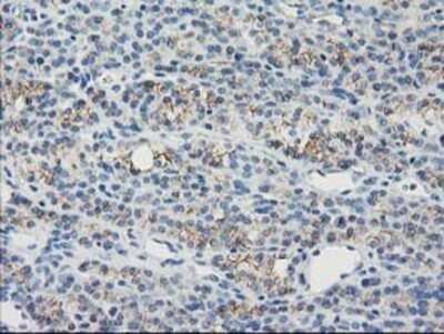 Immunohistochemistry: Guanylate kinase Antibody (OTI4A8) - Azide and BSA Free [NBP2-70869]