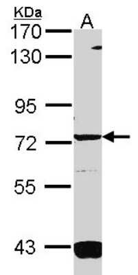 Western Blot: Guanylyl Cyclase alpha 1 Antibody [NBP2-16770]