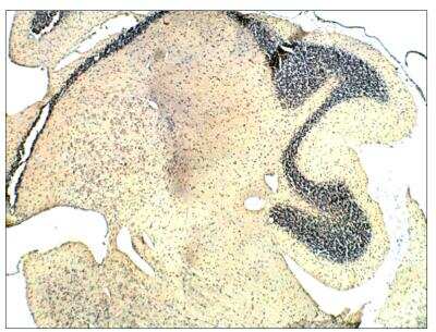 Immunohistochemistry: Guanylyl Cyclase beta 1 Antibody [NBP3-18694]