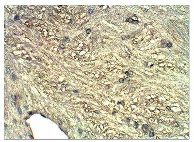 Immunohistochemistry: Guanylyl Cyclase beta 1 Antibody [NBP3-18694]
