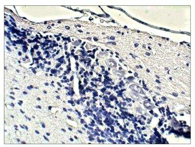 Immunohistochemistry: Guanylyl Cyclase beta 1 Antibody [NBP3-18694]