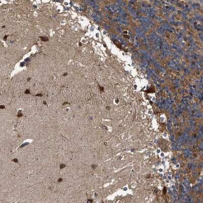 Immunohistochemistry-Paraffin: Guanylyl Cyclase beta 1 Antibody [NBP1-89784]