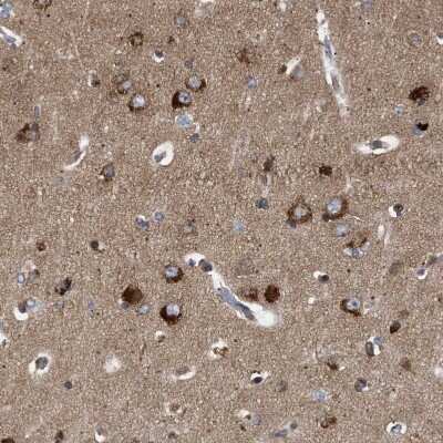 Immunohistochemistry-Paraffin: Guanylyl Cyclase beta 1 Antibody [NBP1-89784]