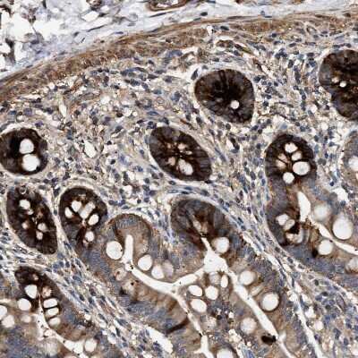 Immunohistochemistry-Paraffin: Guanylyl Cyclase beta 1 Antibody [NBP1-89784]
