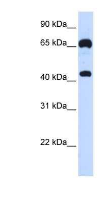 Western Blot: Guanylyl Cyclase beta 1 Antibody [NBP1-58869]
