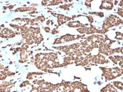 Immunohistochemistry-Paraffin: H1F0 Antibody (AE-4) - Azide and BSA Free [NBP3-08697]