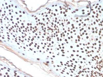 Immunohistochemistry-Paraffin: H1F0 Antibody (AE-4) [NBP3-07712]