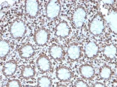 Immunohistochemistry-Paraffin: H1F0 Antibody (AE-4) [NBP3-07712]