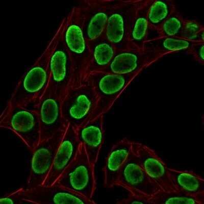 Immunocytochemistry/ Immunofluorescence: H1F0 Antibody (HH1/1784R) - Azide and BSA Free [NBP2-54459]