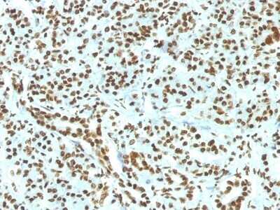 Immunohistochemistry-Paraffin: H1F0 Antibody (HH1/1784R) - Azide and BSA Free [NBP2-54459]