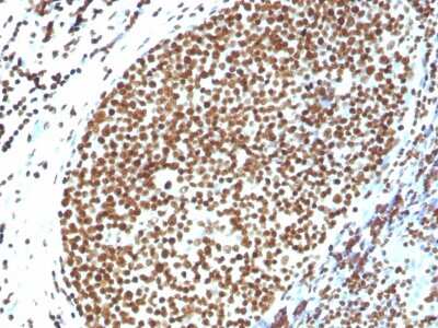 Immunohistochemistry-Paraffin: H1F0 Antibody [NBP3-07713]