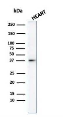 Western Blot: H1F0 Antibody [NBP3-07713]