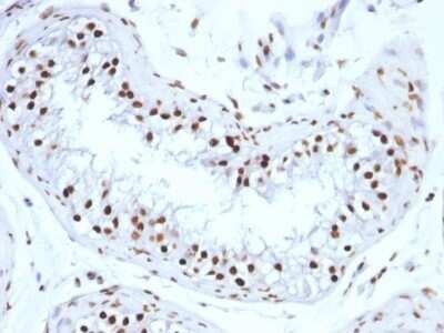 Immunohistochemistry-Paraffin: H1F0 Antibody (SPM256) - IHC-Prediluted [NBP2-48058]