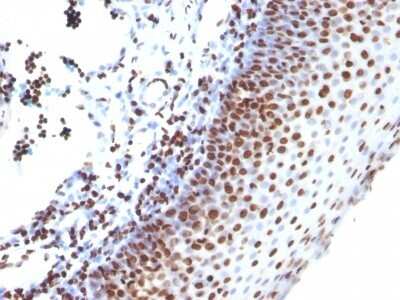 Immunohistochemistry-Paraffin: H1F0 Antibody (SPM256) [NBP2-45183]