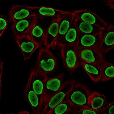 Immunocytochemistry/ Immunofluorescence: H1F0 Antibody (rAE-4) - Azide and BSA Free [NBP3-08690]