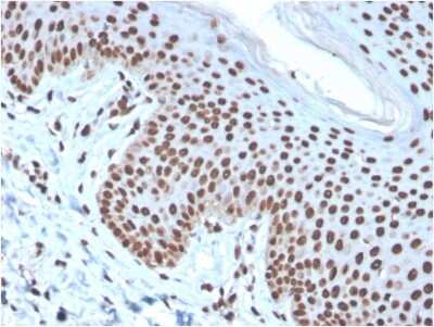 Immunohistochemistry-Paraffin: H1F0 Antibody (rAE-4) - Azide and BSA Free [NBP3-08690]