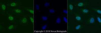 Immunocytochemistry/ Immunofluorescence: Histone H2AX Antibody [NBP2-27428]