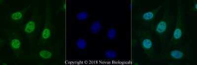 Immunocytochemistry/ Immunofluorescence: Histone H2AX Antibody [NBP2-27428]