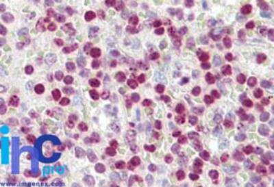 Immunohistochemistry-Paraffin: Histone H2AX Antibody [NBP2-27427]