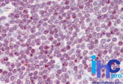 Immunohistochemistry-Paraffin: Histone H2AX Antibody [NBP2-27428]