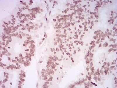 Immunohistochemistry: H4/n Antibody (3E7H2) - BSA Free [NBP2-52486]