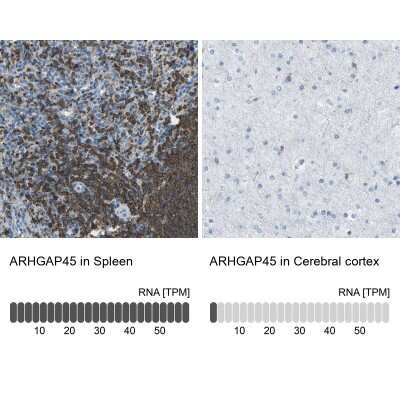 Immunohistochemistry-Paraffin: HA-1 Antibody [NBP1-90107]