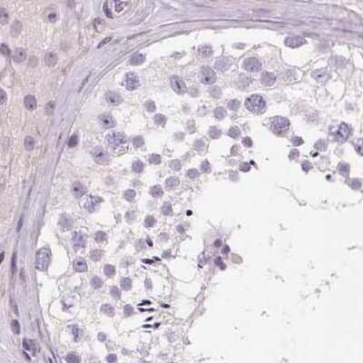 Immunohistochemistry-Paraffin: HAAO Antibody [NBP2-48755]