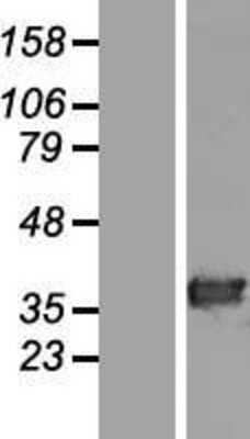 Western Blot: HAAO Overexpression Lysate [NBL1-11431]