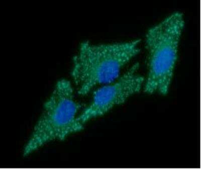 Immunocytochemistry/ Immunofluorescence: HABP1/C1QBP/GC1q R Antibody (1G7) - BSA Free [NBP2-42691]