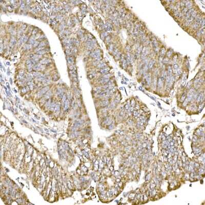 Immunohistochemistry-Paraffin: HABP1/C1QBP/GC1q R Antibody (6N7U3) [NBP3-15368]