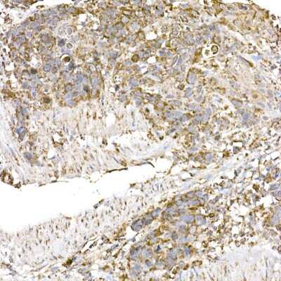 Immunohistochemistry-Paraffin: HABP1/C1QBP/GC1q R Antibody (6N7U3) [NBP3-15368]