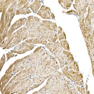Immunohistochemistry-Paraffin: HABP1/C1QBP/GC1q R Antibody (6N7U3) [NBP3-15368]
