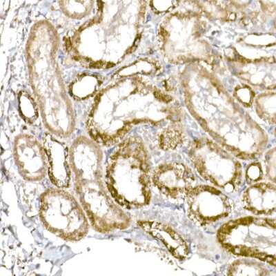 Immunohistochemistry-Paraffin: HABP1/C1QBP/GC1q R Antibody (6N7U3) [NBP3-15368]