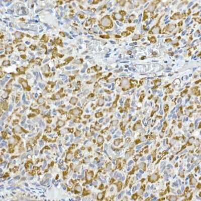 Immunohistochemistry-Paraffin: HABP1/C1QBP/GC1q R Antibody (6N7U3) [NBP3-15368]