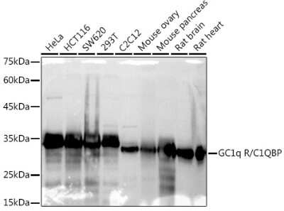 Western Blot: HABP1/C1QBP/GC1q R Antibody (6N7U3) [NBP3-15368]