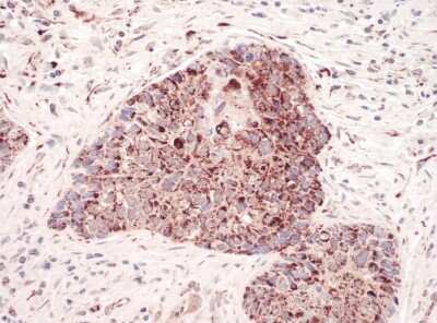 Immunohistochemistry: HABP1/C1QBP/GC1q R Antibody [NBP1-49960]