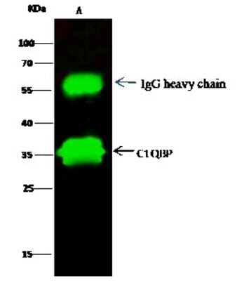 Immunoprecipitation: HABP1/C1QBP/GC1q R Antibody [NBP2-99898]