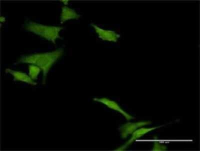 Immunocytochemistry/ Immunofluorescence: HABP4 Antibody [H00022927-D01P]