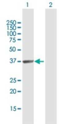 Western Blot: HABP4 Antibody [H00022927-D01P]