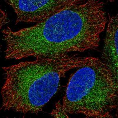 Immunocytochemistry/ Immunofluorescence: HACE1 Antibody [NBP2-58757]